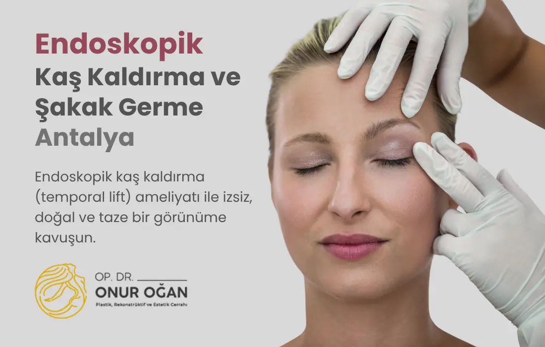 Endoskopik Kaş Kaldırma ve Şakak Germe Antalya Op. Dr. Onur Oğan