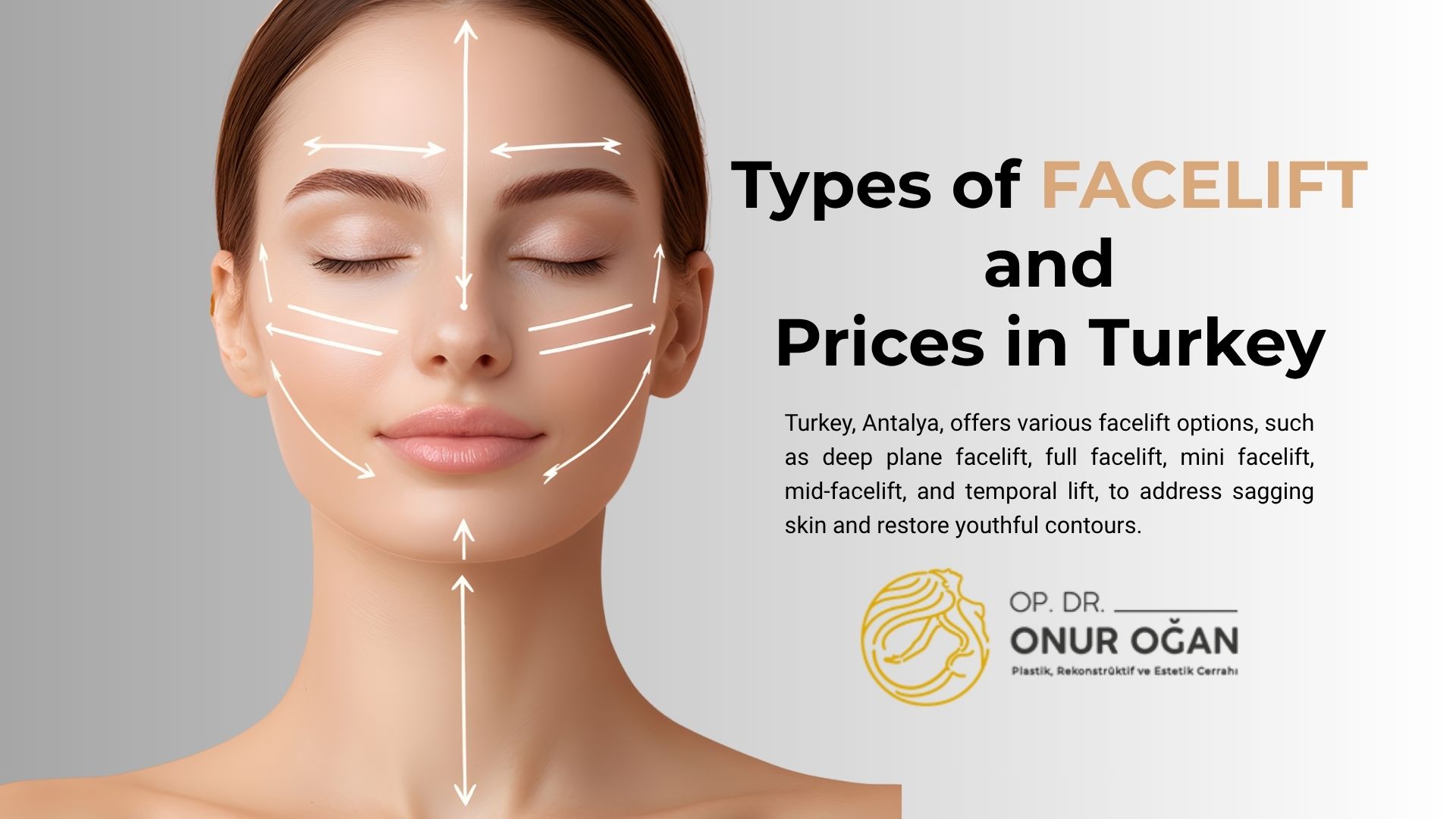 Types of Facelifts and Costs 
