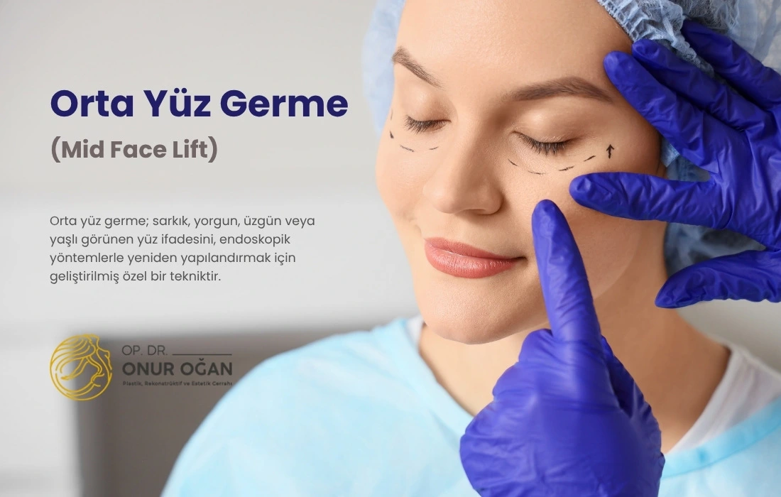 Antalya Orta Yüz Germe, Fiyatları