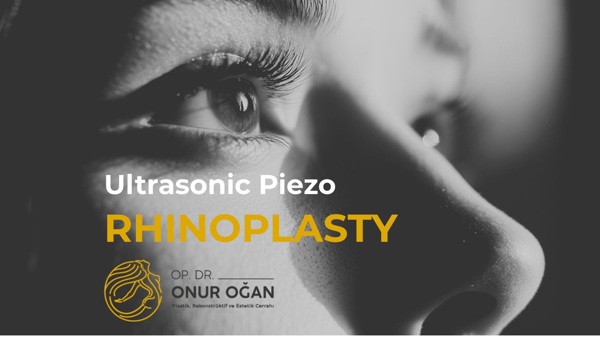 ultrasonic-piezo-rhinoplasty-in-turkey