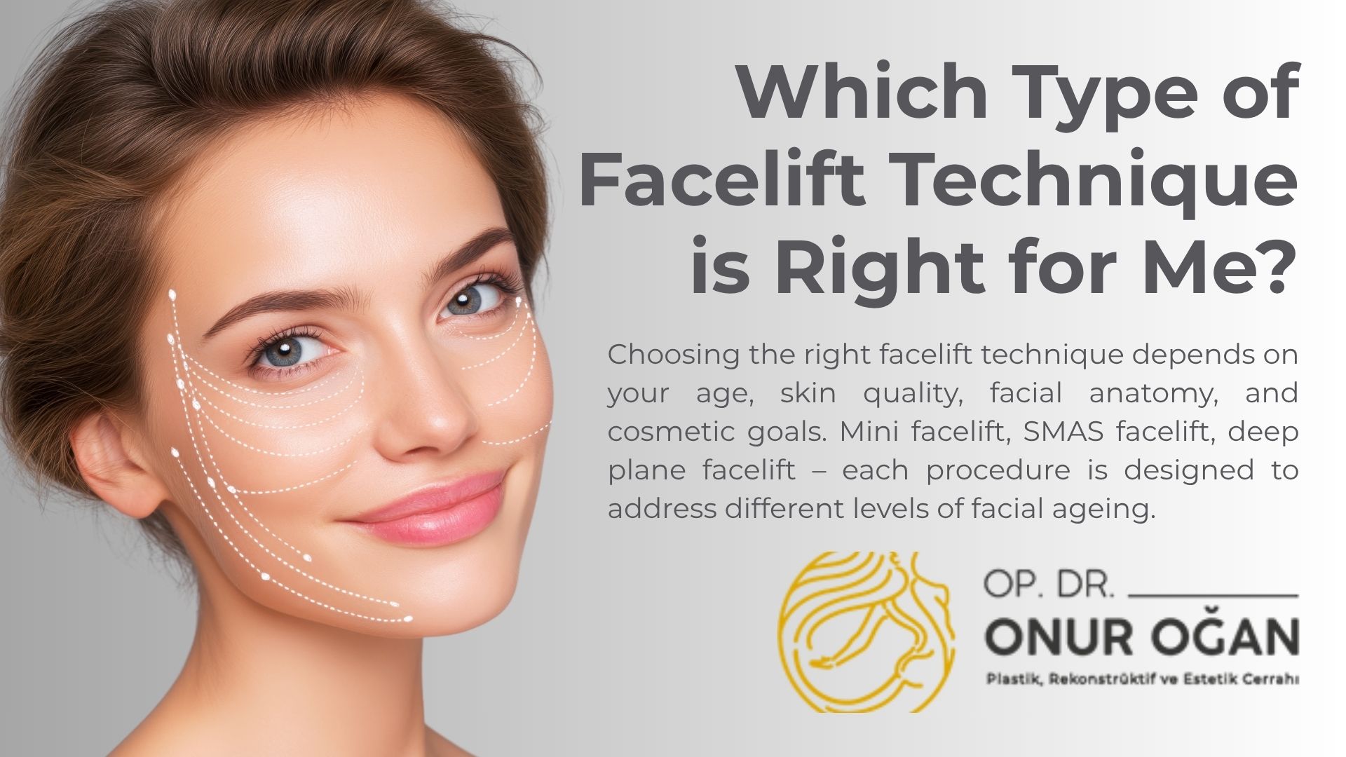 which-type-of-facelift-technique-is-right-for-me?