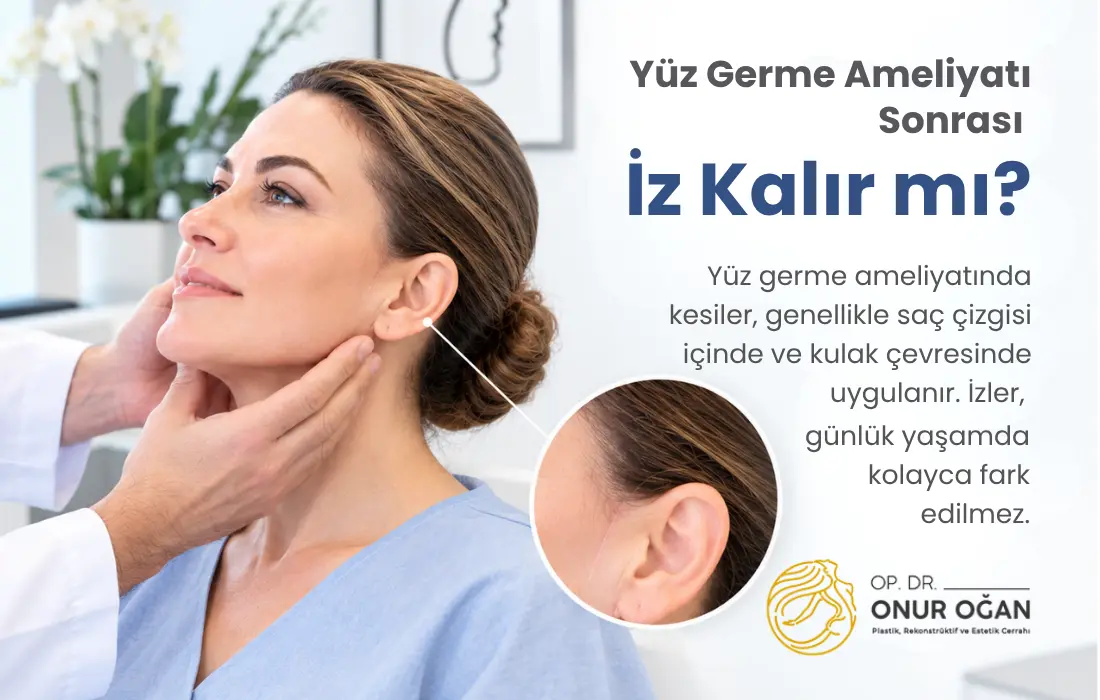 Yüz germe ameliyatı sonrası iz kalır mı?