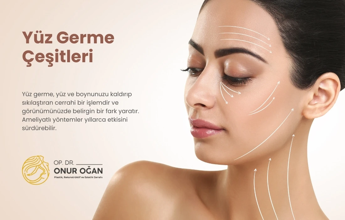 Yüz Germe Çeşitleri